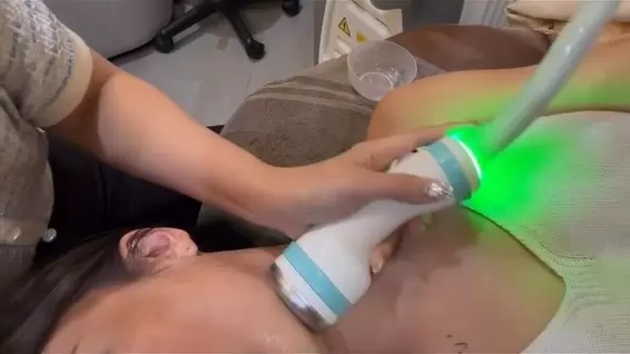 ONDA昂達超微波將肉鬆臉推回骨架邊界 輪廓線條貼骨浮現