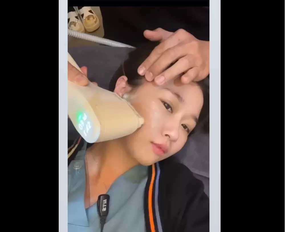  LINEAR Z「Z音波」Q+立線音波的升級版 改善臉部肌膚鬆、垮、垂等問題