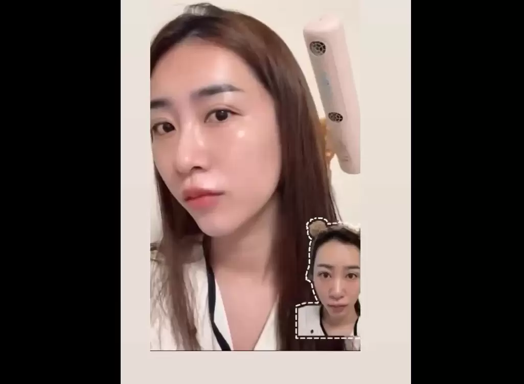 不喜歡雷射或對光敏感 羨慕韓星的水嫩肌？水光注射是不錯的選擇