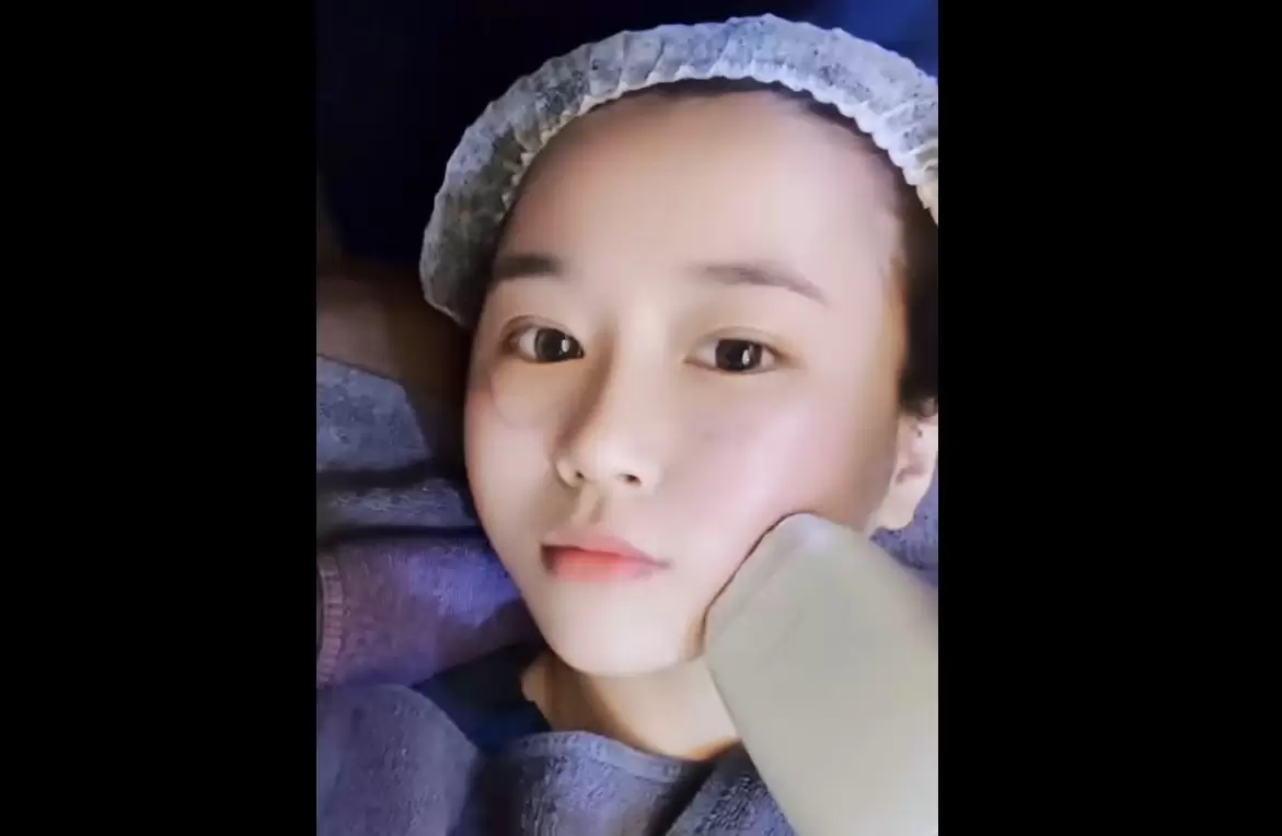 索夫波Sofwave 電音波雙重效果 改善肌膚鬆弛紋路 重現緊緻輪廓線