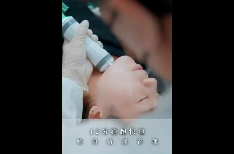 ONDA昂達超微波 肉鬆臉法令紋雙下巴 臉頸輪廓線管理 12分鐘超快速