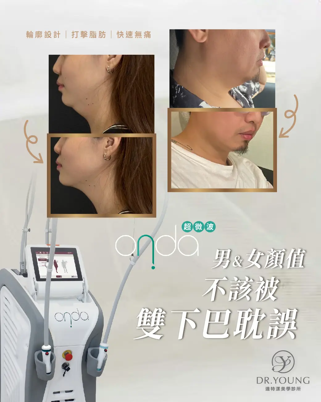 ONDA昂達超微波｜輪廓清晰，顏值自然到位